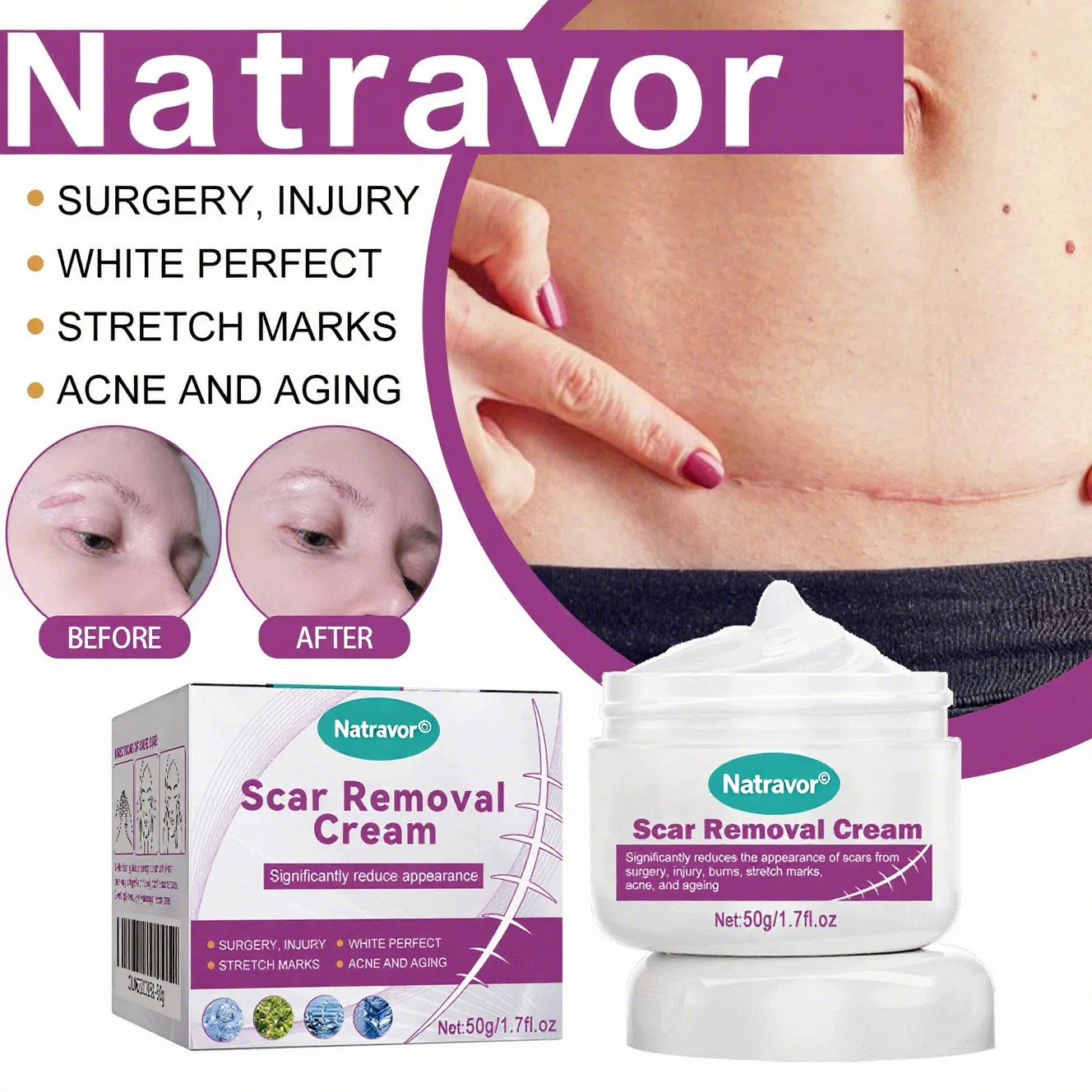 Quick-Acting Scar Removal Cream for Visible Results