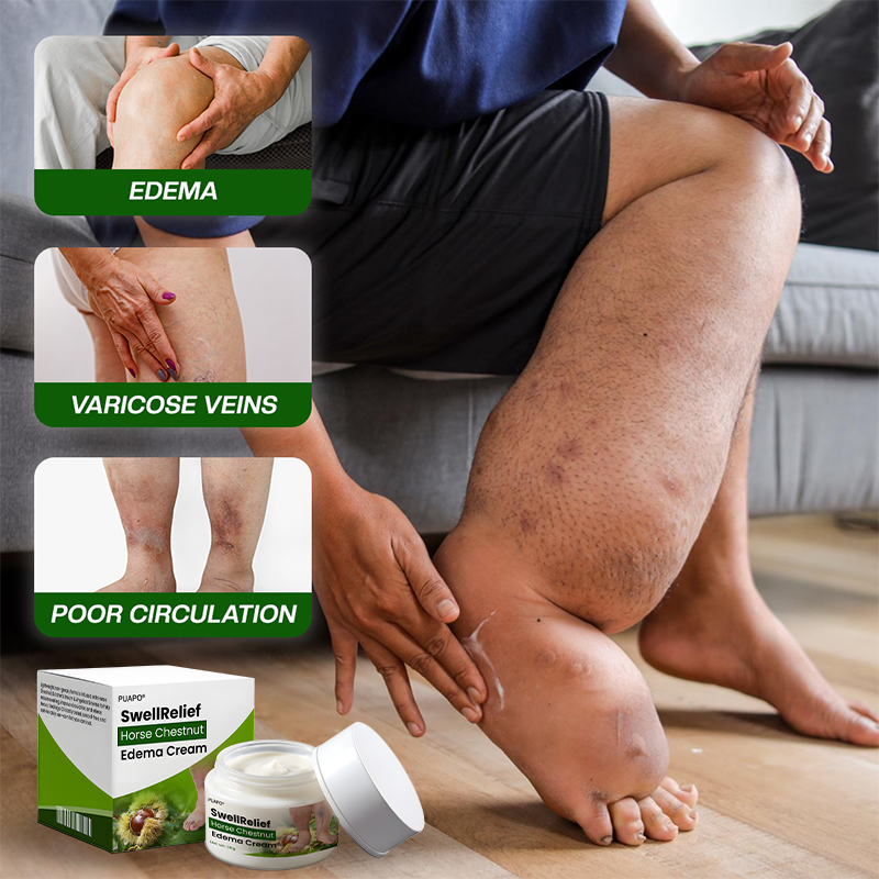 Puapo® SwellRelief Horse Chestnut Edema Cream