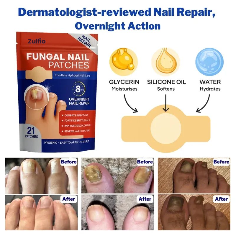 Nighttime Antifungal Nail Patches