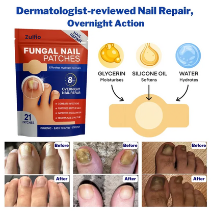 Nighttime Antifungal Nail Patches