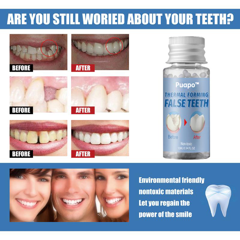 Dental Repair Kit – Stop Paying $500+ at the Dentist, Fix It Yourself at Home! 🦷