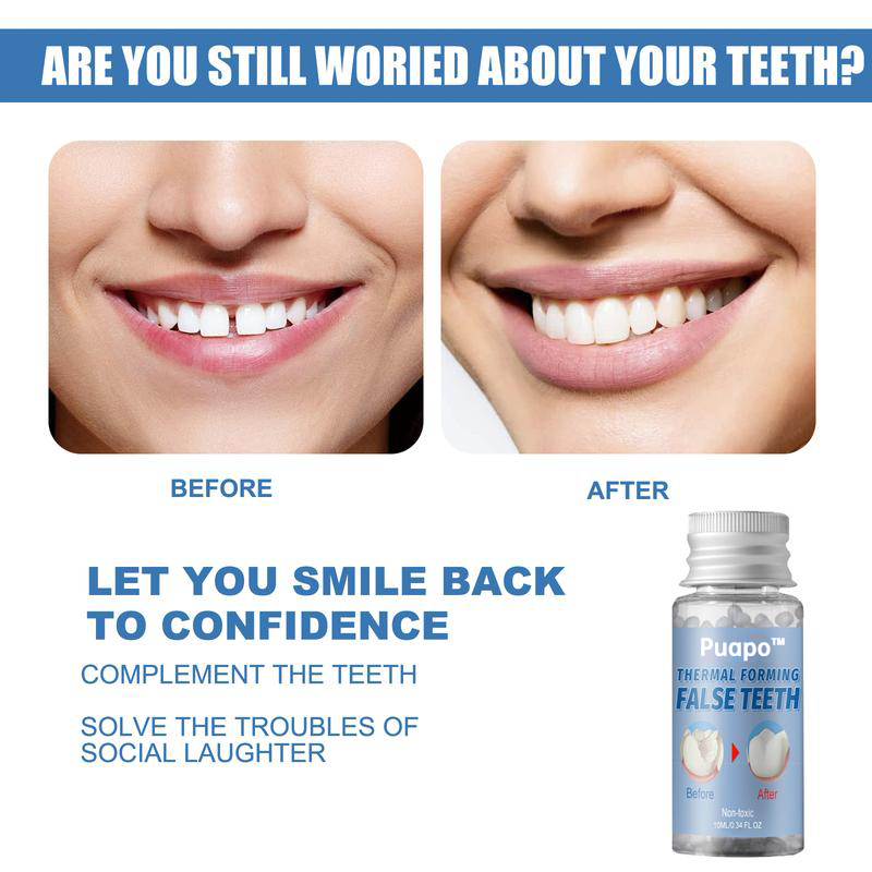 Dental Repair Kit – Stop Paying $500+ at the Dentist, Fix It Yourself at Home! 🦷