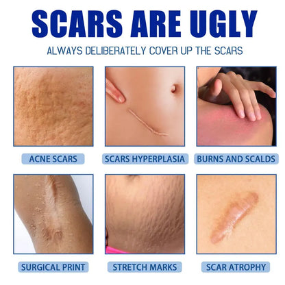 Professional Scar Removal Gel