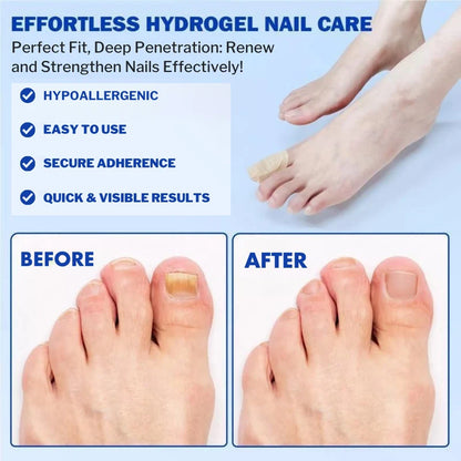 Nighttime Antifungal Nail Patches