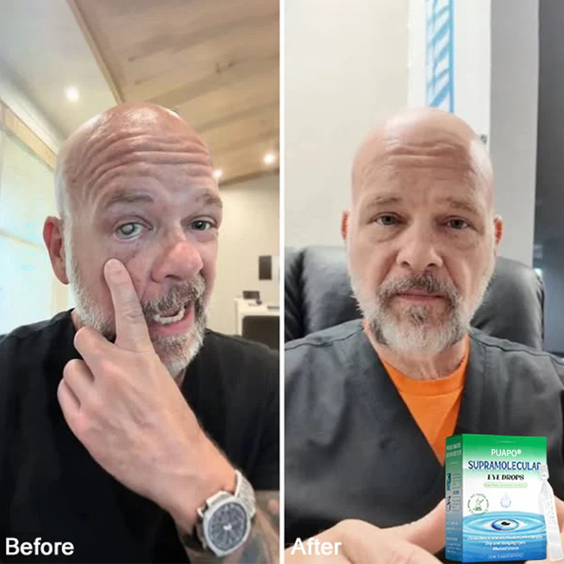 👩‍⚕️PUAPO® Supramolecular Eye Drops ✅MHRA approved (Suitable for cataracts, floaters, AMD and presbyopia) 🍀🍀